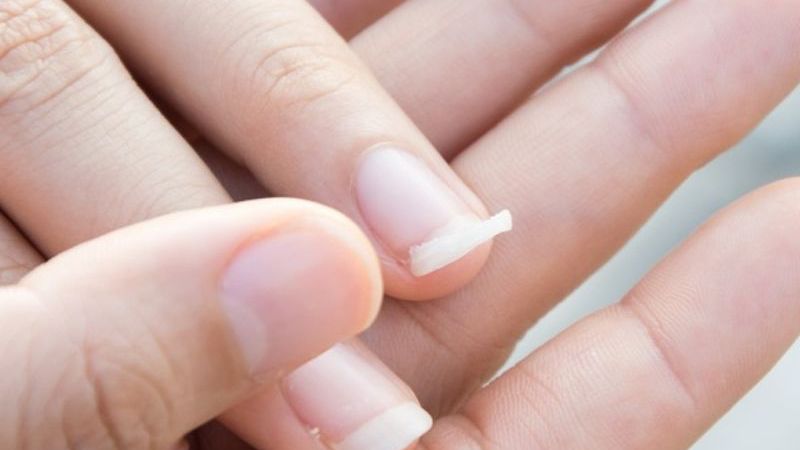 Cách làm móng tay nhanh dài trong 2 ngày tại nhà 2