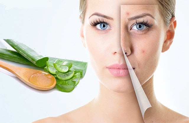 Cách làm xẹp mụn sưng đỏ sau 1 đêm bạn đã biết chưa? 2