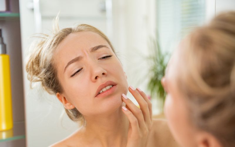 Cách nhận biết da bị kích ứng mỹ phẩm 2