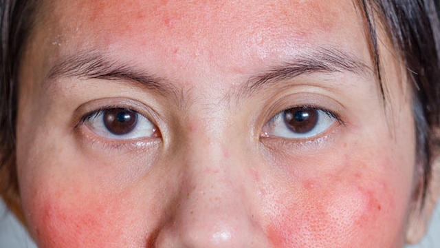 Cách nhận biết sự khác biệt giữa La Roche Posay Duo+ hàng thật và hàng giả 2