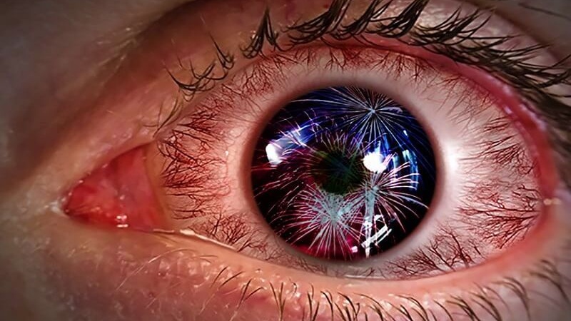 Cách test loạn thị tại nhà và tại phòng khám chuyên khoa 1