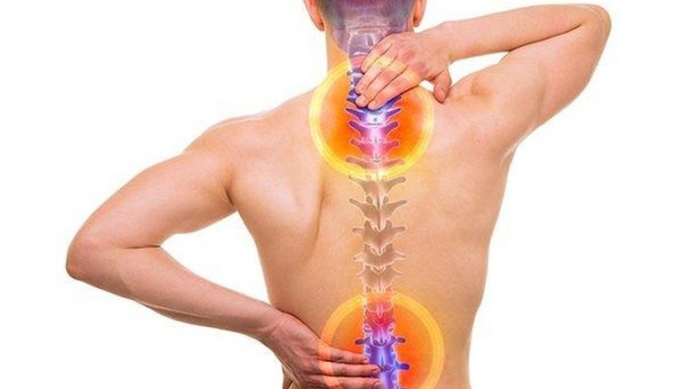 Cách trị gai cột sống lưng tại nhà đơn giản, dễ thực hiện
