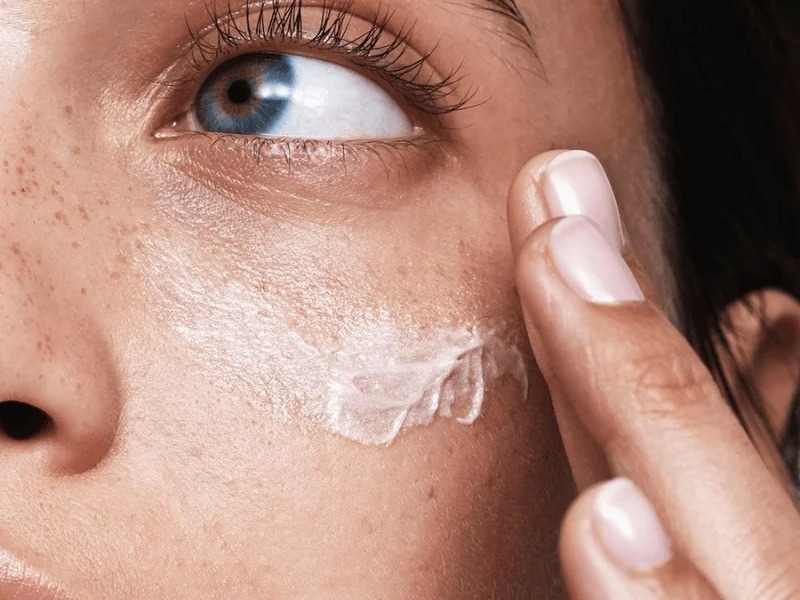 Cách trị tàn nhang tận gốc không phải ai cũng biết 3