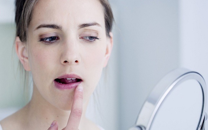Cách trị viêm môi dị ứng tại nhà có hiệu quả không?