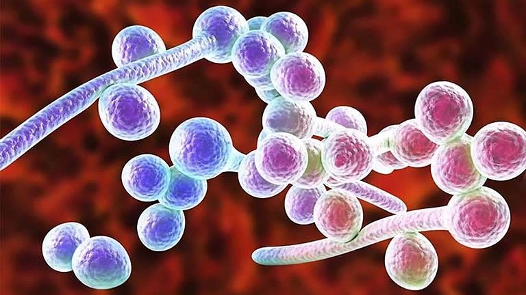 cach-tu-dieu-tri-nam-candida-hieu-qua-tai-nha-1.jpg