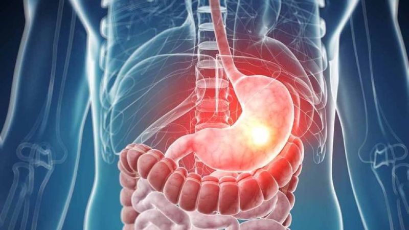 Cách xử trí cầm máu xuất huyết tiêu hóa 2