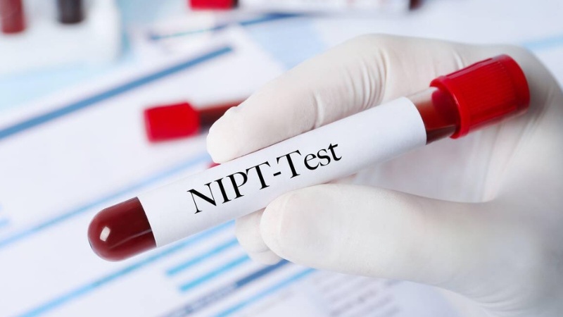 Cẩm nang mang thai: Mẹ bầu nên làm gói xét nghiệm NIPT nào 1