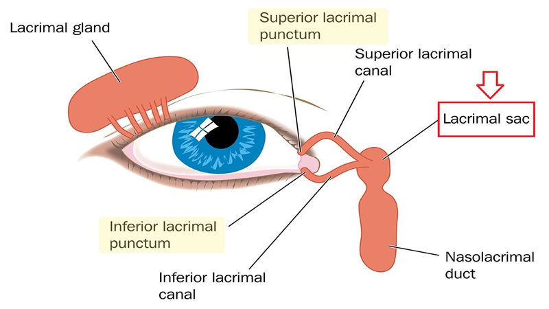 Cắt bỏ túi lệ: Trường hợp chỉ định, quy trình và cách xử trí tai biến 5