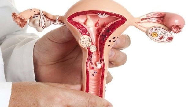 Cắt buồng trứng ảnh hưởng đến sức khoẻ như thế nào? 2