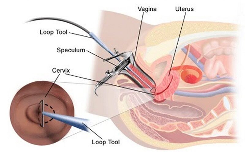 cat-leep-co-tu-cung-va-nhung-dieu-can-biet 1.jpg