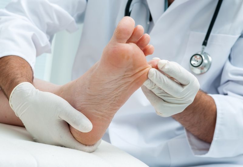 Cắt móng cho người đái tháo đường được không? Cần lưu ý gì? 2