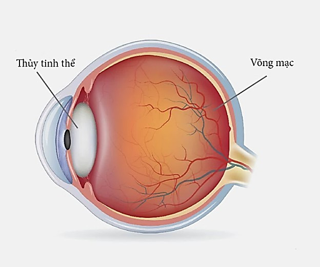 Cấu tạo của thuỷ tinh thể bao gồm những gì? Vai trò của thủy tinh thể đối với mắt? 2