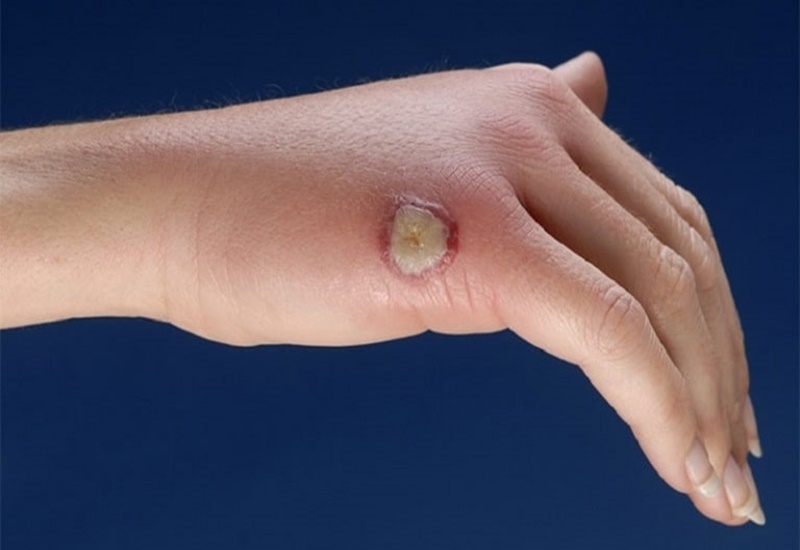 Cây xạ đen trị bệnh gì? Hướng dẫn bài thuốc dùng xạ đen trị bệnh hiệu quả 5