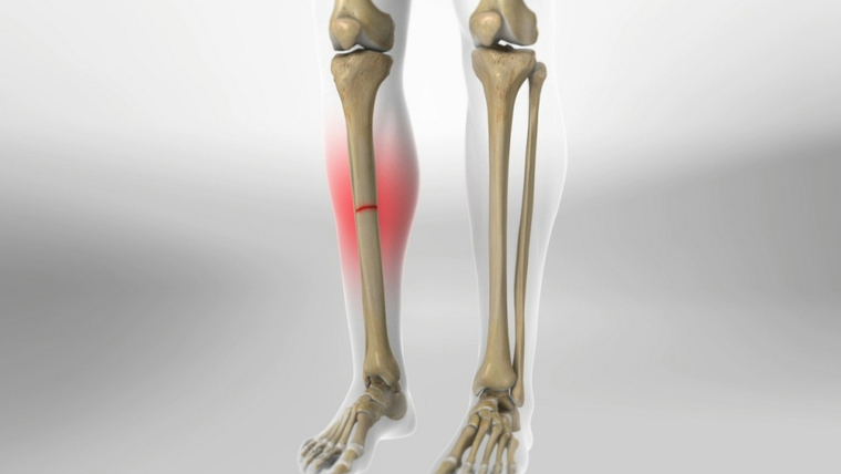 cham-lien-xuong-nguyen-nhan-va-dau-hieu-la-gi 1.jpg