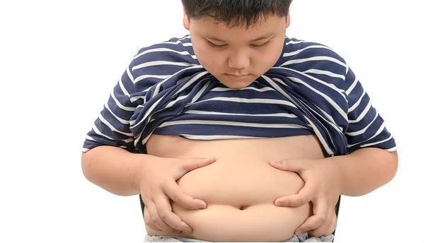 Trẻ béo phì 3