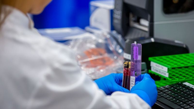 Chẩn đoán ung thư đại trực tràng bằng sinh thiết lỏng Guardant Reveal 4