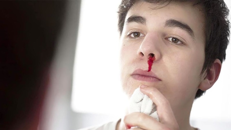 Chảy máu khi bị sốt xuất huyết 02