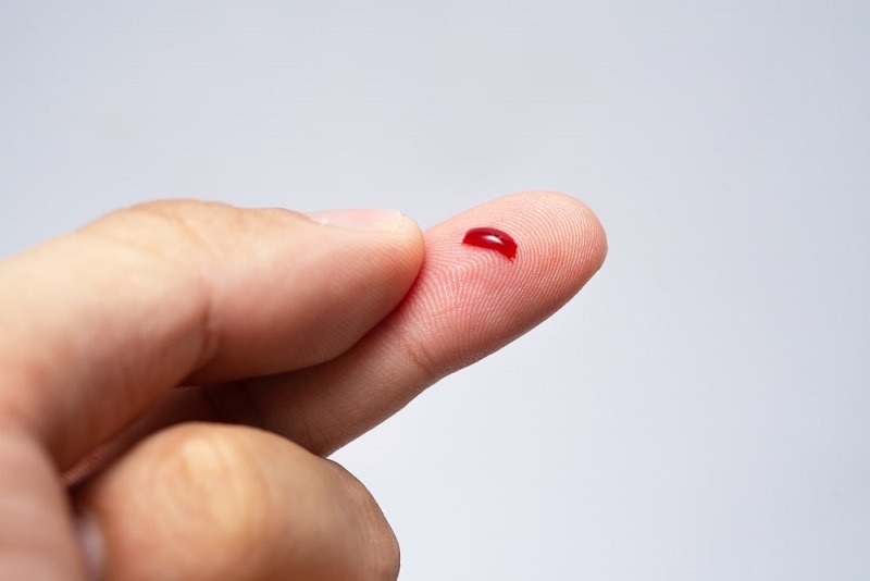 chay-mau-mao-mach-co-dac-diem-gi 1.jpg