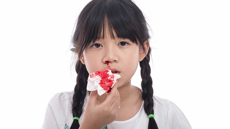 Chảy máu mũi nên làm gì? Nguyên nhân chảy máu mũi do đâu 4