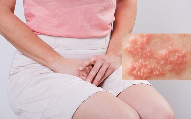 chi-phi-chua-sui-mao-ga-het-bao-nhieu-tien 2