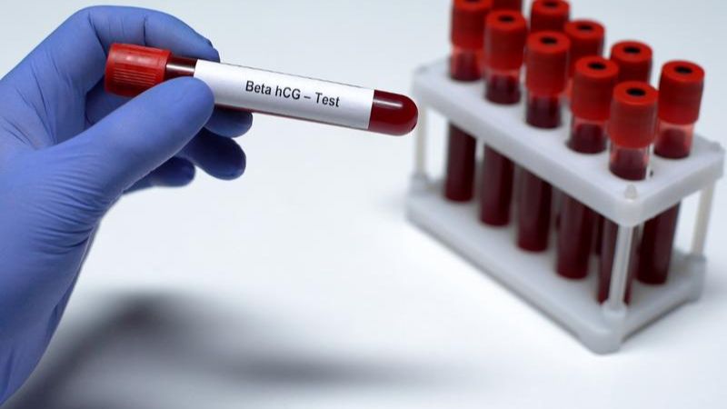 Chỉ số beta bao nhiêu thì có phôi thai? 1
