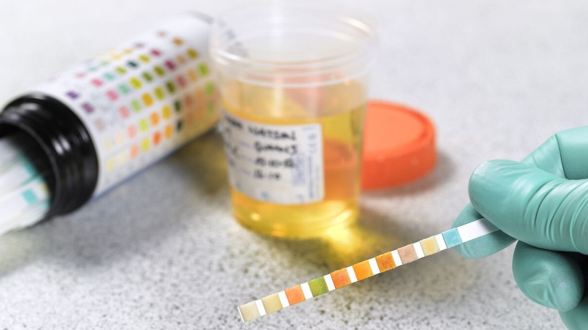 Uxlab yotgan ayolning porno suratlari