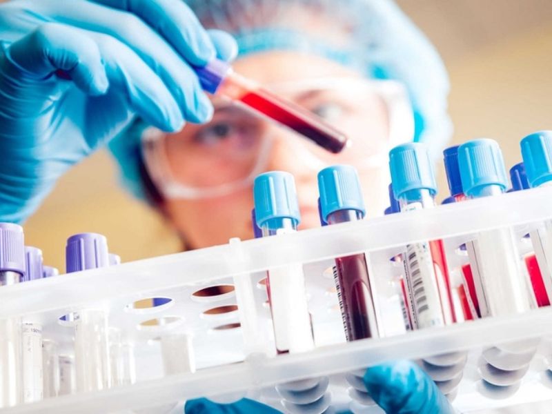 Chỉ số CRP ở trẻ em cao có sao không? Ý nghĩa của chỉ số CRP 1