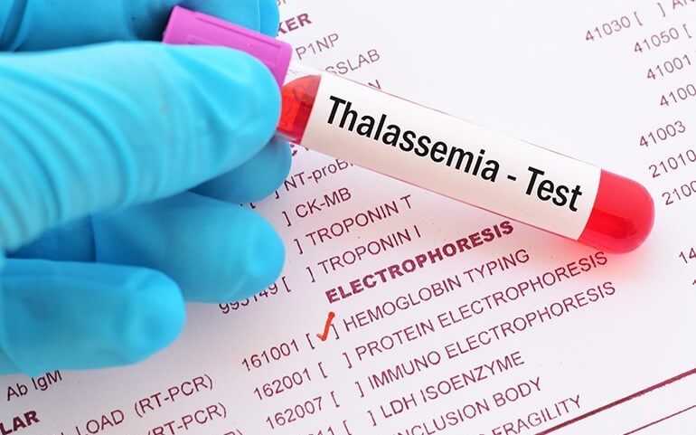 chi-so-huyet-sac-to-cao-phai-lam-gi 2.jpg