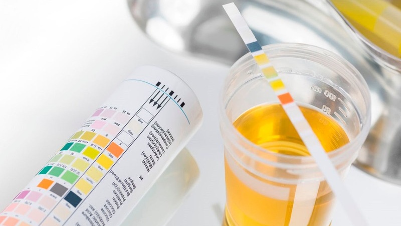 Chỉ số LEU 70 trong nước tiểu là gì?