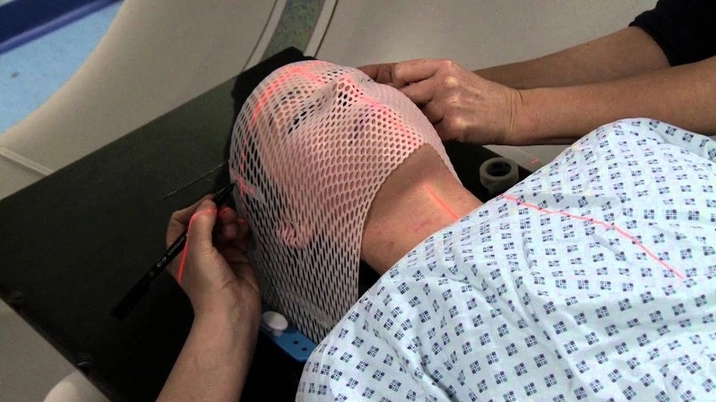 Chiếc mặt nạ xạ trị được làm như thế nào? 3