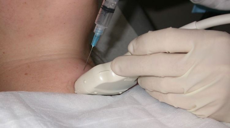 choc-hut-te-bao-bang-kim-nho-trong-chan-doan-benh-ly-y-khoa 1.jpg