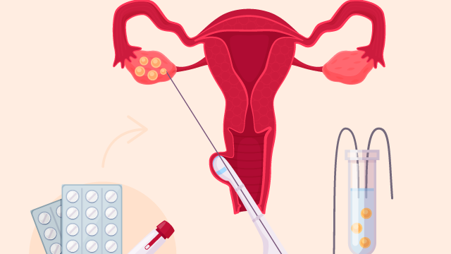 Chọc hút trứng: Quá trình, các biến chứng thường gặp và những điều cần lưu ý 1