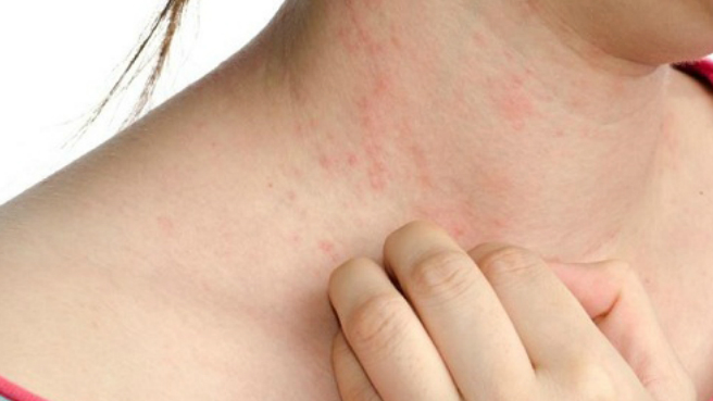 chup-ct-co-hai-khong-chup-ct-tac-dong-den-co-the-nhu-the-nao 4