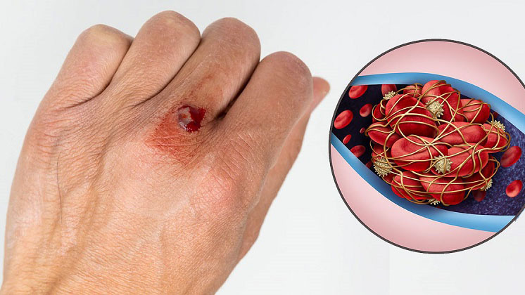 Chụp MRI vú là gì? Khi nào cần thực hiện? 4