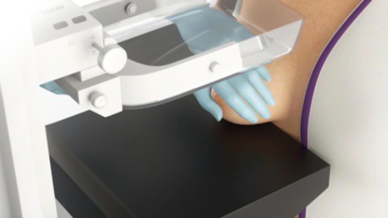 Chụp nhũ ảnh tăng cường độ tương phản (CEM) là gì? 3