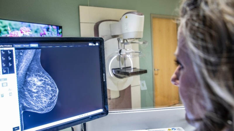 Chụp nhũ ảnh tăng cường độ tương phản (CEM) là gì? 1