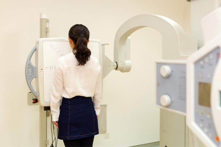 Chụp X quang có gây ung thư không? Tác động của tia X và biện pháp bảo vệ sức khỏe 3