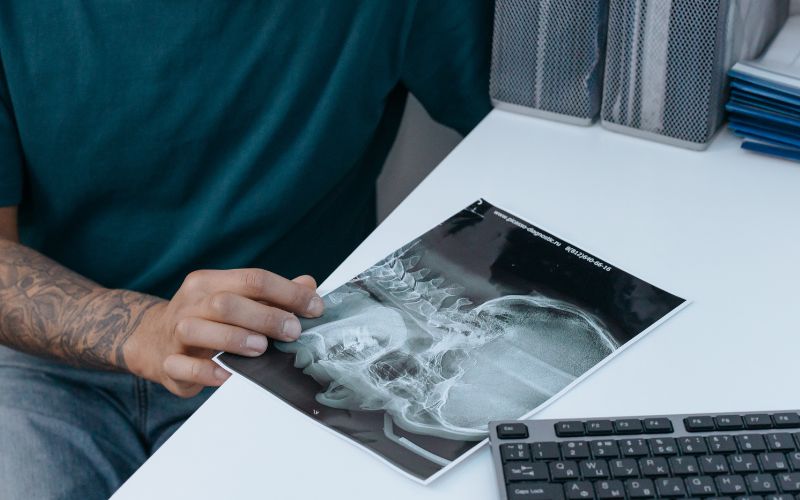 Chụp X-quang đầu cho bé có hại không là lo lắng của nhiều phụ huynh