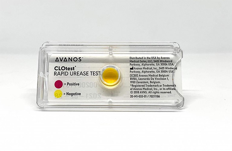 Clo test là gì? Thực hiện Clo test như thế nào? 3