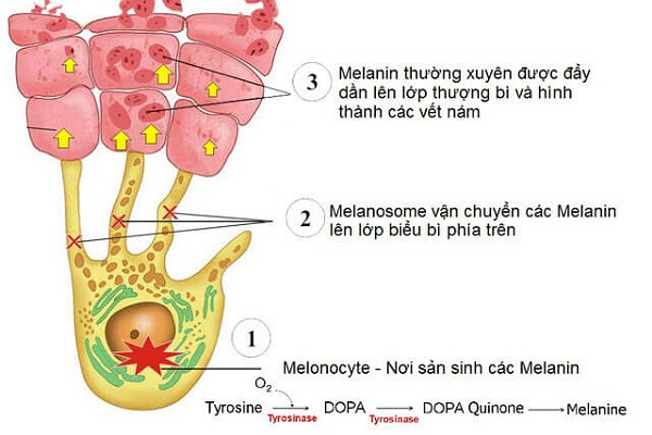 Cơ chế hình thành melanin gây nám da