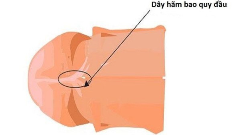 Có nên áp dụng các cách làm dài dây thắng bao quy đầu không? 3