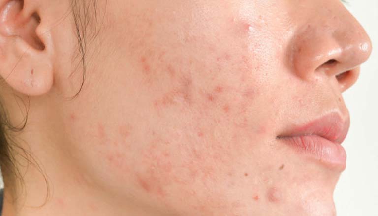 Có nên kết hợp ceramide và niacinamide trong chăm sóc da? 7