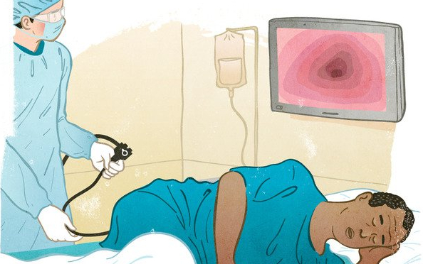 Có những phương pháp nội soi đường ruột phổ biến nào? 4