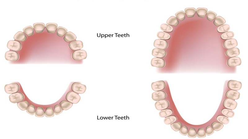 Con người có bao nhiêu cái răng? Phân loại và cấu tạo răng người 1