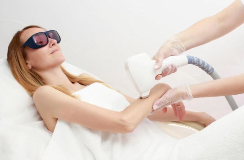 Công nghệ triệt lông DPL là gì? Có hiệu quả không? 1