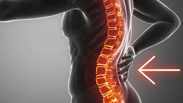 Cột sống lưng bị lõm có nguy hiểm không? 2