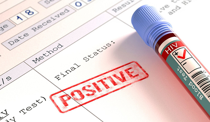 Csbt là gì? Kết quả xét nghiệm dương tính và âm tính có ý nghĩa gì? 3