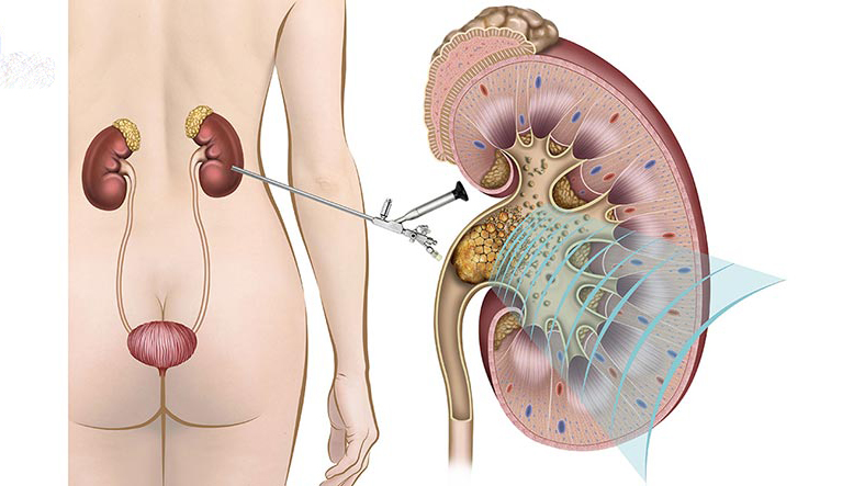 Củ dền đỏ có tác dụng gì? Những lưu ý khi ăn củ dền đỏ 4