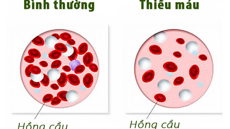Củ dền đỏ có tác dụng gì? Những lưu ý khi ăn củ dền đỏ 2
