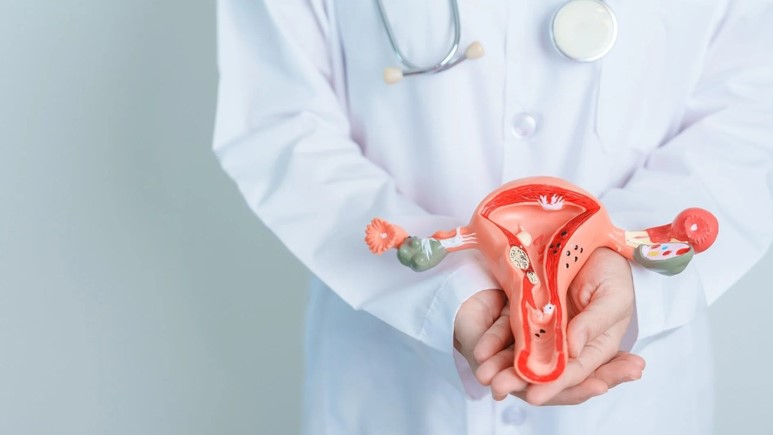 Cùng chuyên gia giải đáp: Ung thư cổ tử cung giai đoạn 1 sống được bao lâu? 1